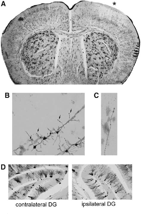 Figure From Controlled Cortical Impact Results In An Extensive Loss