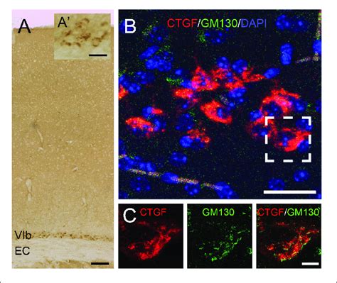 expression  ctgf   cerebral cortex ctgf  expressed