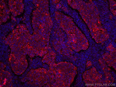 LGALS3BP Monoclonal Antibody 2D8E11 CoraLite594 Proteintech 100 μL