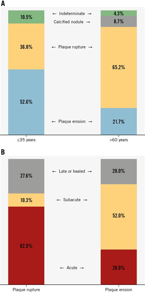 Oct Based Comparative Evaluation Of Culprit Lesion Morphology In Very