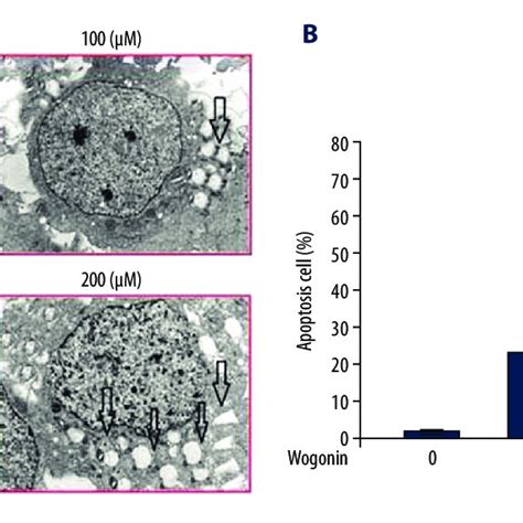 Effect Of Wogonin On Morphology Of A2780 Cells By Transmission Electron