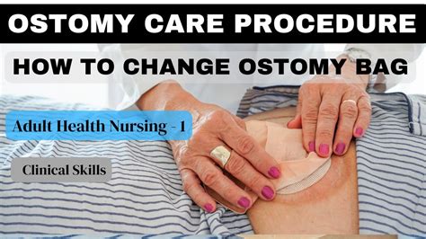 Ostomy Care Nursing Procedure I Adult Health Nursing I I Clinical