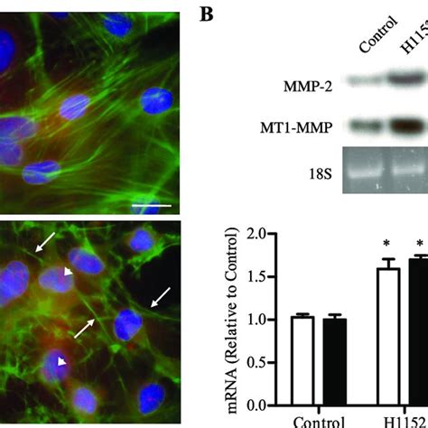 Inhibition Of Rock Induces Mmp 2 And Mt1 Mmp Mrna Expression In A C Jun