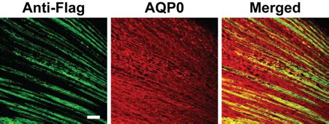 Microinjection Of Recombinant Rcas A Retrovirus Into Embryonic Chicken