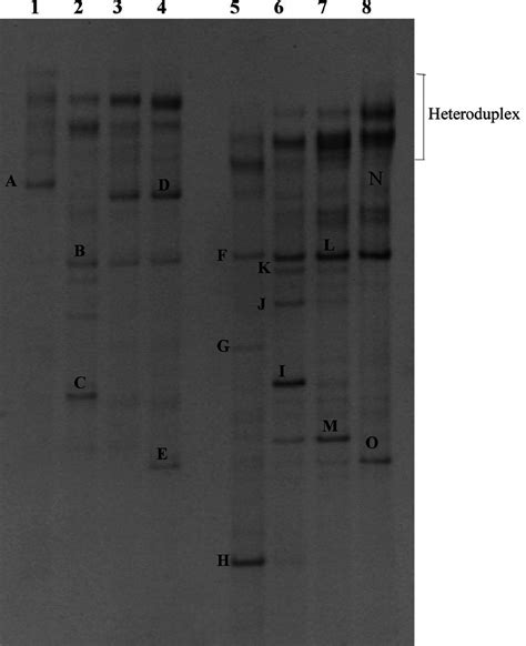 Bacterial Dgge Pro Fi Les Of Dna Lanes 1 To 4 And Rna Lanes 5 To 8 Download Scientific