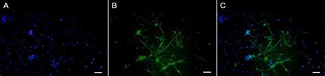 The Pathways By Which Mild Hypothermia Inhibits Neuronal Apo