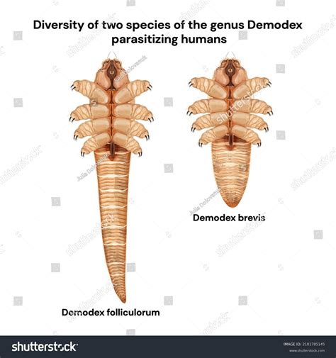 Diversity Two Species Genus Demodex Parasitizing Stock Vector Royalty Free 2181785145