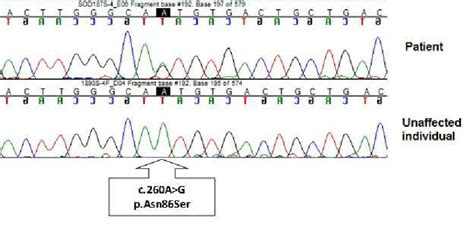 Dna Sequence Chromatograms Showing The C260a G Mutation And The