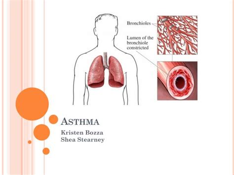 Ppt Asthma Powerpoint Presentation Free Download Id2644055