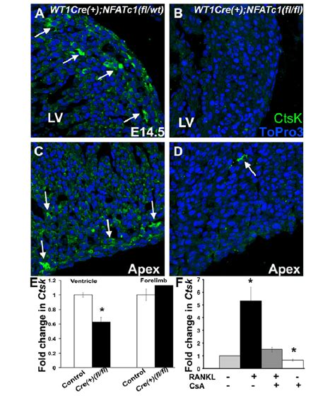 Wt1 Crenfatc1flfl Embryos Have Reduced Ctsk Expression In The Download Scientific