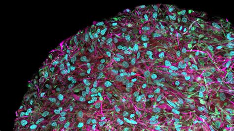 Organoid Intelligence A New Biocomputing Frontier