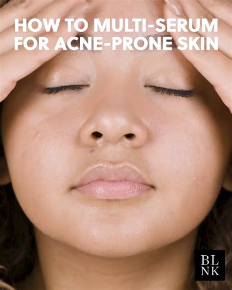 How To Multi Serum For Acne Prone Skin Productos Para El Acné Acné Tratamiento Productos