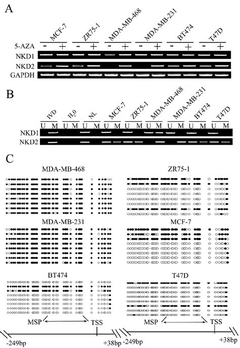 The Expression And Methylation Status Of NKD1 And NKD2 In Breast Cancer