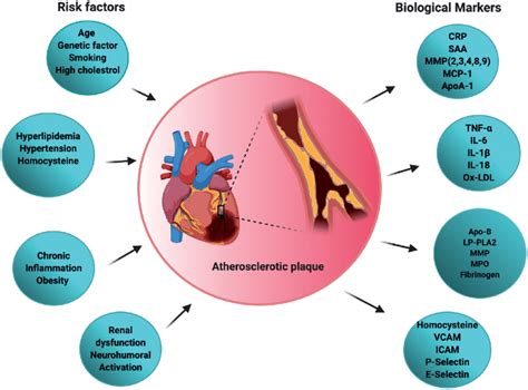 Atherosclerosis Diagram