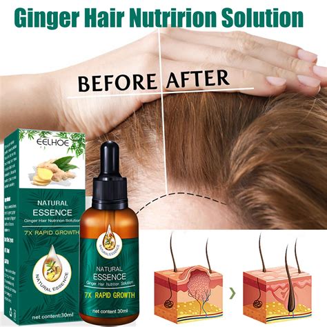 Ginger Hair Growth Essential Oil Serum Anti Loss Products Fast Grow Treatment Repair Scalp Dry