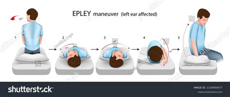 epley maneuver royalty  images stock  pictures