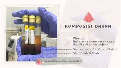 Platelet Rich Plasma Aifalogy Mindful Parenting Blog