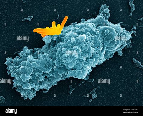 Macrophage Engulfing Bacteria Coloured Scanning Electron Micrograph