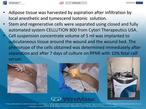 EWMA 2014 EP457 AUTOTRANSPLANTATION OF THE ADIPOSE TISSUE DERIVED