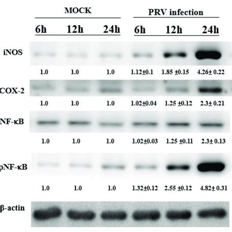 The Inos Cox 2 And Nf κb P65 Expression In Non Or Prv Infected Bv 2