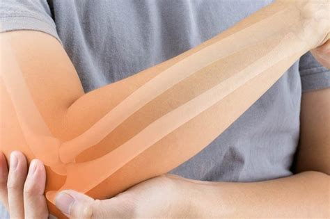 Osteoporoz Kemik Erimesi Nedir Nedenleri Nelerdir Negatif Net Hot Sex