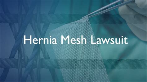 Hernia Mesh Lawsuit Attorneys Youtube