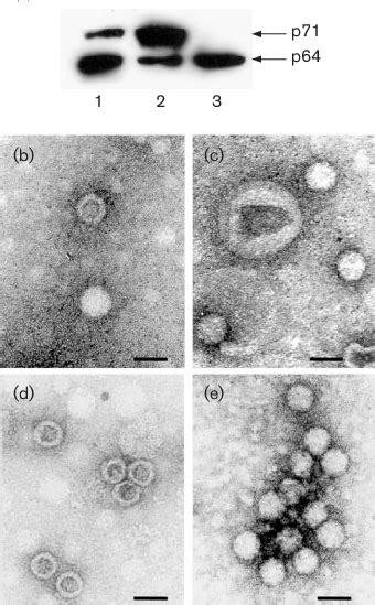 Purification Of Hasv Vlps A Western Blot Analysis Of Vlps Purified