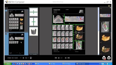 Tutorial Cs D Imaging Software Carestream Impresion Hasta