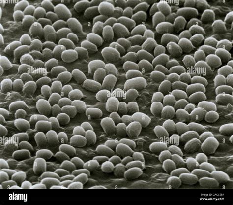 Bacillus Anthracis Spores Scanning Electron Micrograph Sem Of