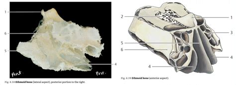 Ethmoid Bone Diagram | Quizlet