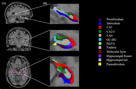 Frontiers The Volume Of Hippocampal Subfields In Relation To Decline