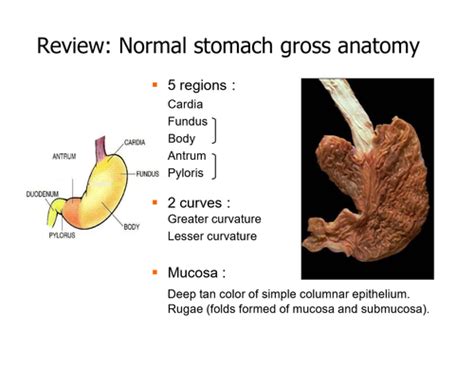 Submucosal Gastric Lesion