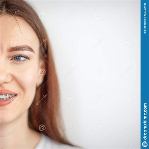 Le Sourire Dune Jeune Fille Avec Des Bagues Sur Ses Dents Blanches