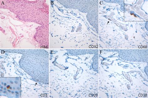 Immunohistochemistry Of Adjacent Sections Of Normal Conjunctiva