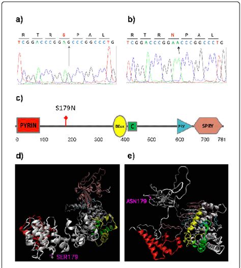 Identification Of G G2 096A P S179N Mutation In The MEFV Gene