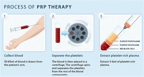 Prp Facial Platelet Rich Plasma At Revitalize Maui