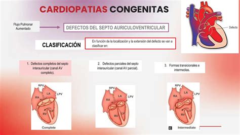 Cardiopatia Congenitas Clasificacion Presentacion Clinicas Y