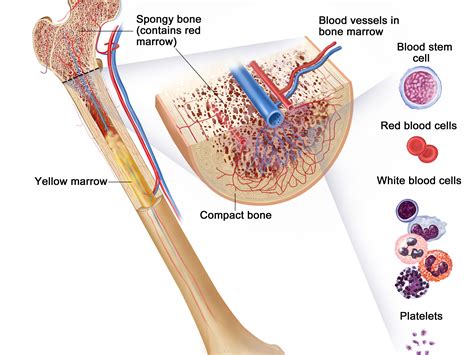 Leukemia—Patient Version - NCI