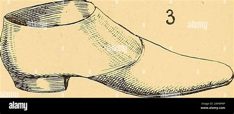 Diseases Of The Hip Knee And Ankle Joints With Their Deformities