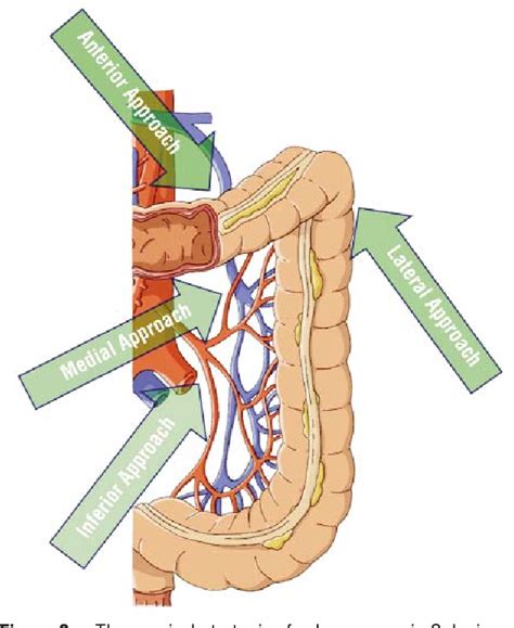 Splenic Flexure