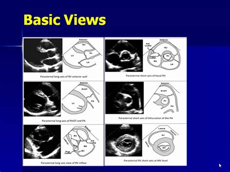 Echocardiography of The right ventricle - YouTube