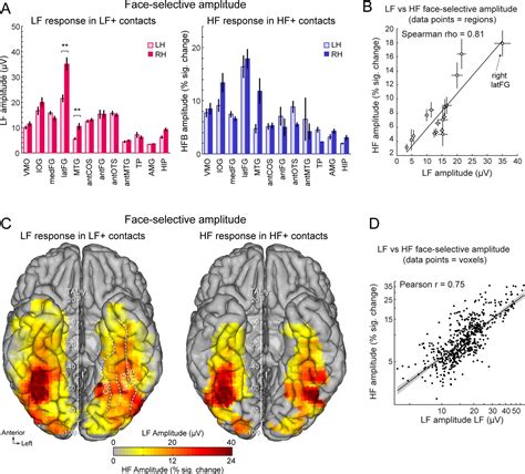 Low And High Frequency Intracranial Neural Signals Match In The Human