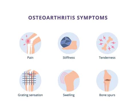 Osteoarthritis: Symptoms, Causes, Risk Factors,, 60% OFF