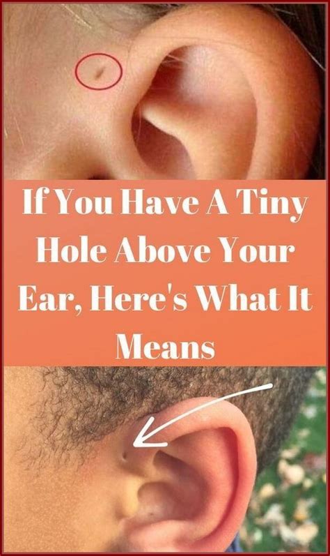 If You Have A Tiny Hole Above Your Ear Here’s What It Means In 2022 Ear Holes Health Facts