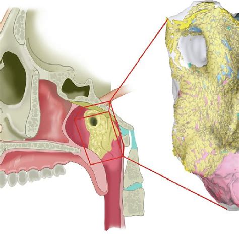 Anatomy of the torus tubarius area. Macroscopic views of the torus... | Download Scientific Diagram