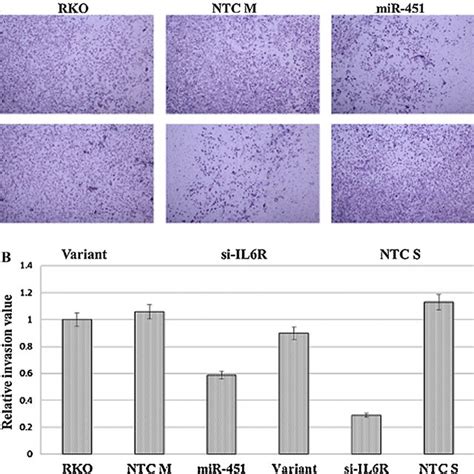 Western Blot Analysis Of The IL6R Protein In RKO A And Hela B