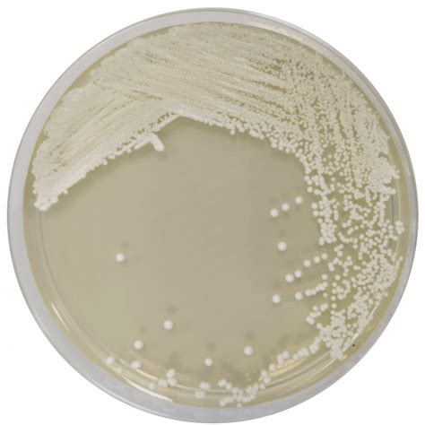 Agar Dextrosa Sabouraud Con Cloranfenicol Ep Usp Iso Formato G