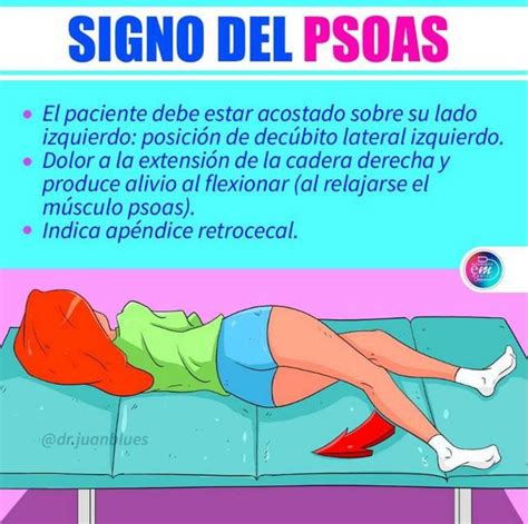 Signo Del Psoas