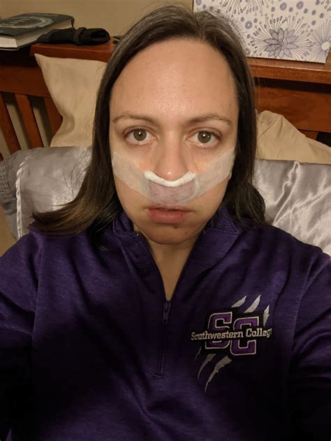 My Deviated Septum Surgery And Recovery Septoplasty With Turbinate Reduction Part 2 Surgery