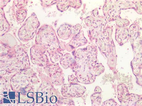 Ihc Plus™ Cd276 B7 H3 Polyclonal Antibody Rabbit Anti Human Lsbio